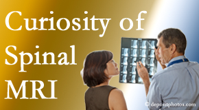 Toronto MRIs for spinal stenosis may be revealing…or confusing.