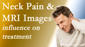 Yorkville Chiropractic and Wellness Centre takes into consideration MRI findings like Modic Changes when setting up a neck pain relieving treatment plan.