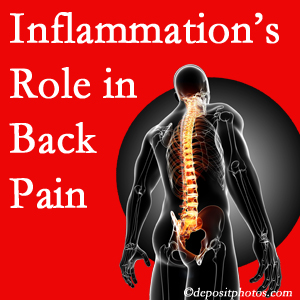 The role of inflammation in Toronto back pain is real. Chiropractic care can help.