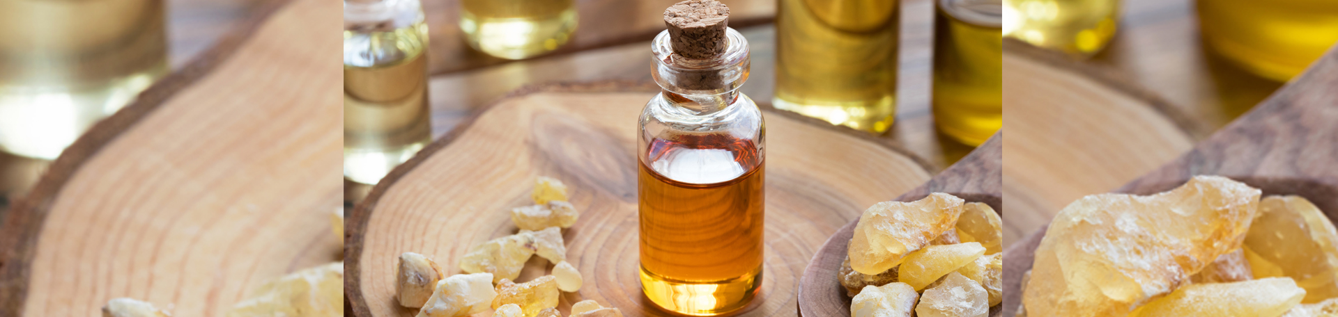 Toronto anti-inflammatory frankincense