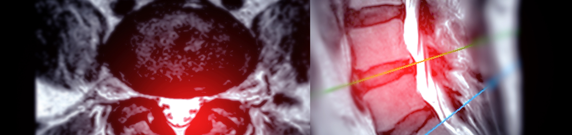 Toronto back pain imaging and exercise