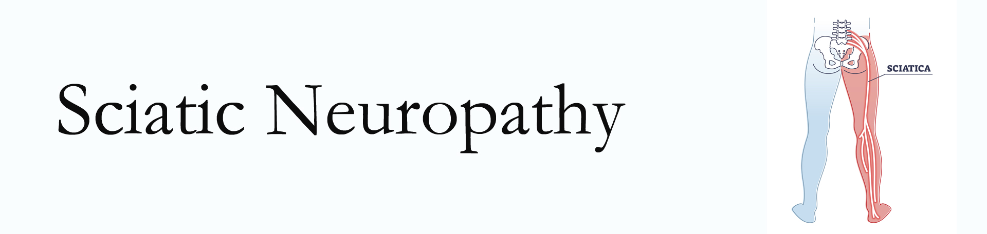 Toronto neuropathy pain (sciatica)