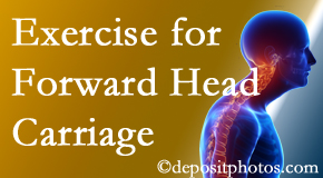 Toronto chiropractic treatment of forward head carriage is two-fold: manipulation and exercise.