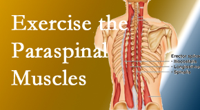 Yorkville Chiropractic and Wellness Centre explains the importance of paraspinal muscles and their strength for Toronto back pain relief.