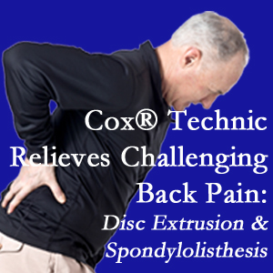 Toronto chiropractic care with Cox Technic alleviates back pain due to a painful combination of a disc extrusion and a spondylolytic spondylolisthesis.