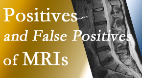 Yorkville Chiropractic and Wellness Centre carefully chooses when and if MRI images are needed to guide the Toronto chiropractic treatment plan. 