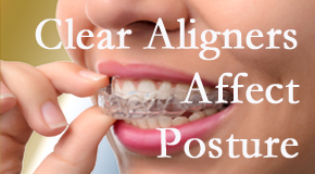 Clear aligners influence posture which Toronto chiropractic helps.