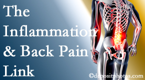 Yorkville Chiropractic and Wellness Centre tackles the inflammatory process that accompanies back pain as well as the pain itself.