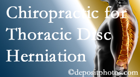 Yorkville Chiropractic and Wellness Centre diagnoses and manages thoracic disc herniation pain and relieves its symptoms like unexplained abdominal pain or other gastrointestinal issues. 