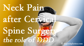 Yorkville Chiropractic and Wellness Centre offers gentle care for neck pain after neck surgery.