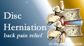 Yorkville Chiropractic and Wellness Centre uses non-surgical treatment for relief of disc herniation related back pain. 