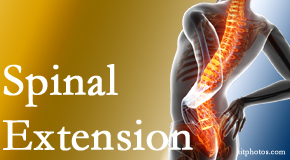 Yorkville Chiropractic and Wellness Centre knows the role of extension in spinal motion, its necessity, its benefits and potential harmful effects. 