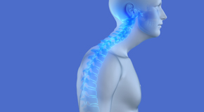relief of Toronto kyphosis pain