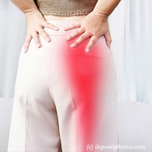 image of Toronto leg pain, sciatica, lumbar radiculopathy