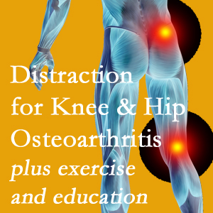 A chiropractic treatment plan for Toronto knee pain and hip pain due to osteoarthritis: education, exercise, distraction.