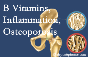 Toronto chiropractic care of osteoporosis usually comes with nutritional tips like b vitamins for inflammation reduction and for prevention.
