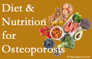 Toronto osteoporosis prevention tips from your chiropractor include improved diet and nutrition and decreased sodium, bad fats, and sugar intake. 