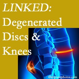 Degenerated discs and degenerated knees are not such unlikely companions. They are seen to be related. Toronto patients with a loss of disc height due to disc degeneration often also have knee pain related to degeneration.  